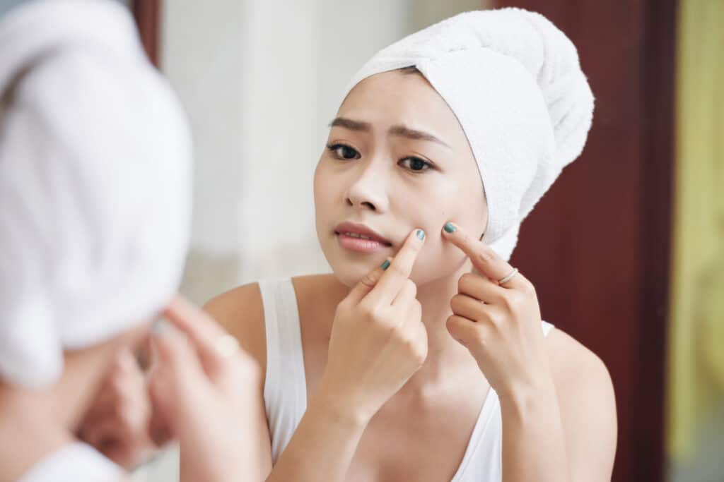 Asian woman popping pimples in 517701